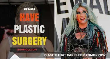 Kesha's Transformation: Plastic Surgery Rumors and the Truth Behind Them
