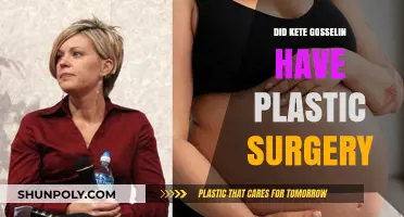Kate Gosselin's Transformation: Plastic Surgery Rumors Explored and Debunked