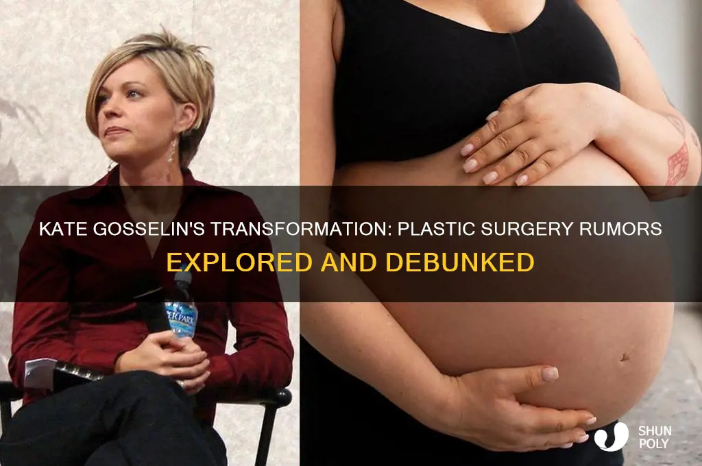 did kete gosselin have plastic surgery