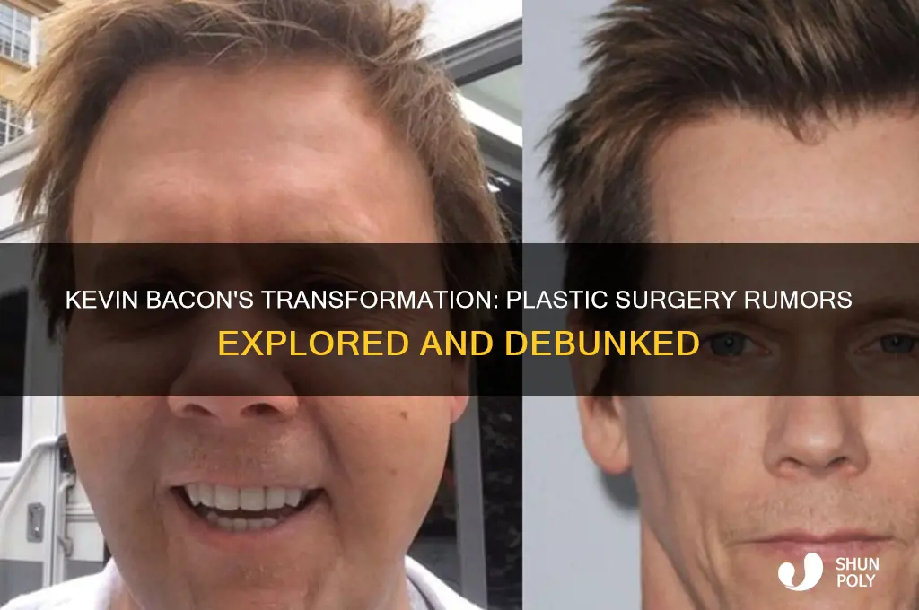 did kevin bacon have plastic surgery