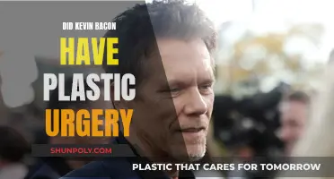 Kevin Bacon's Plastic Surgery: Did He or Didn't He?