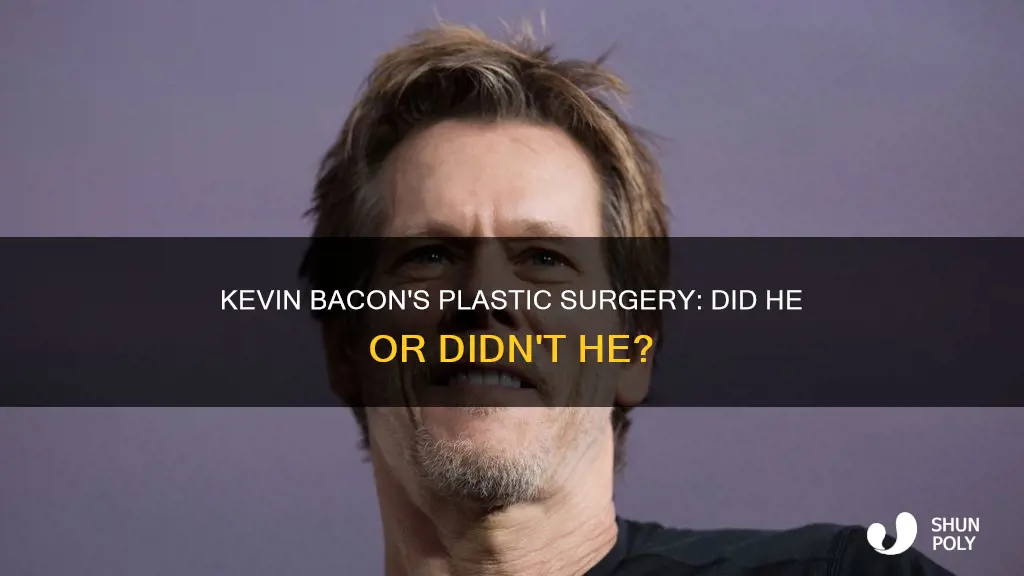 did kevin bacon have plastic urgery