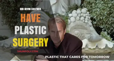 Kevin Costner's Transformation: Plastic Surgery Rumors Explored