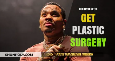 Kevin Gates Plastic Surgery: Fact-Checking the Rumors and Speculations