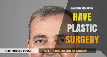 Kevin McCarthy's Transformation: Plastic Surgery Speculations and Facts