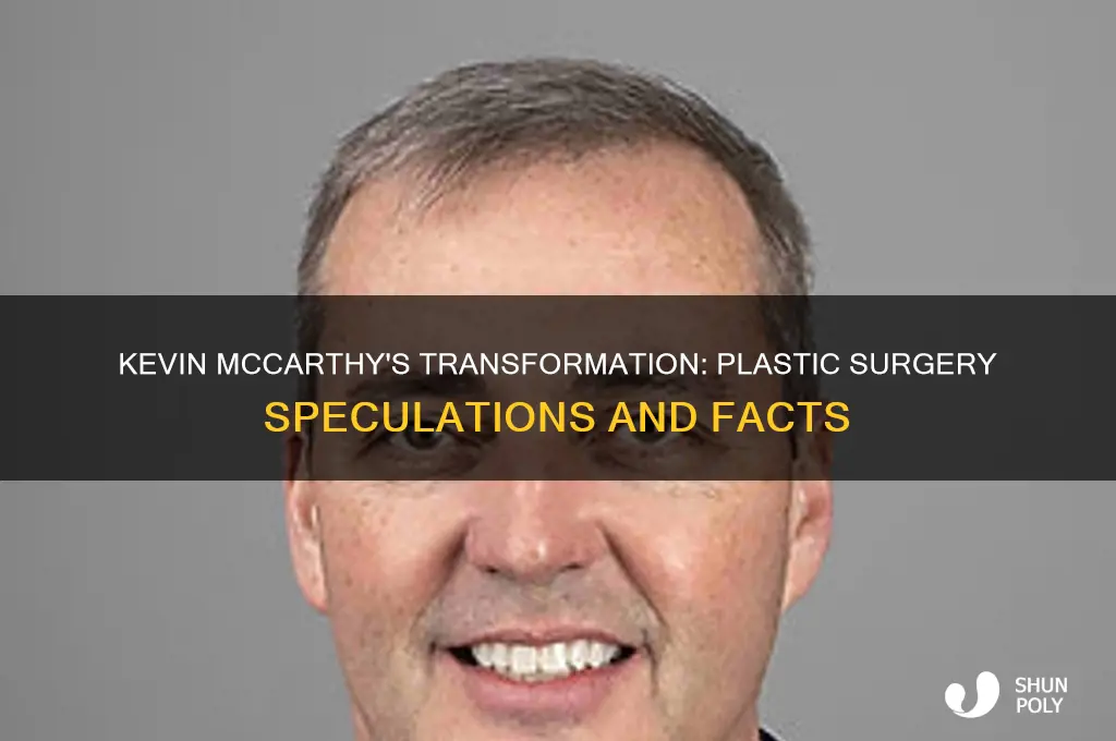 did kevin mccarthy have plastic surgery