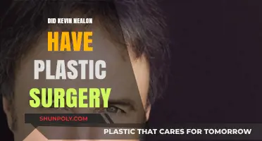 Kevin Nealon's Transformation: Plastic Surgery Speculations and Truths
