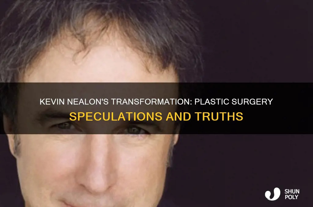 did kevin nealon have plastic surgery