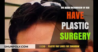 Kevin Richardson's Transformation: Plastic Surgery Rumors Explored