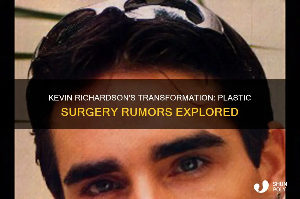 did kevin richardson of bsb have plastic surgery
