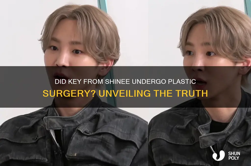 did key shinee have plastic surgery