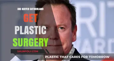 Kiefer Sutherland's Transformation: Plastic Surgery Rumors Explored