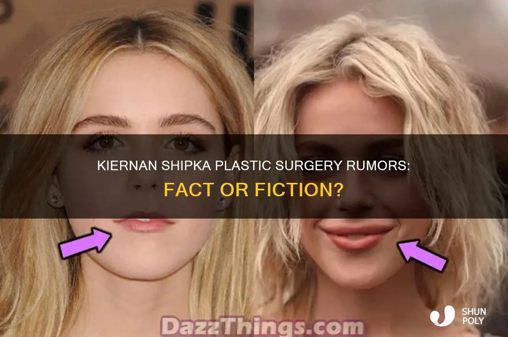 did kiernan shipka get plastic surgery