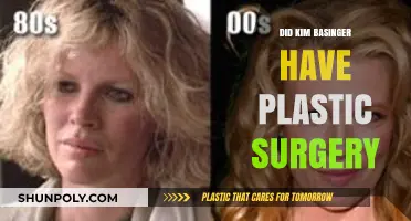 Kim Basinger Plastic Surgery: Fact-Checking the Rumors and Speculations