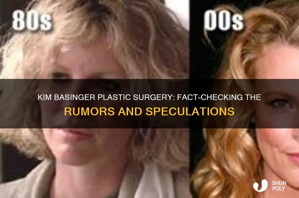 did kim basinger have plastic surgery