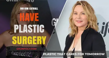 Kim Cattrall's Transformation: Plastic Surgery Rumors and Reality