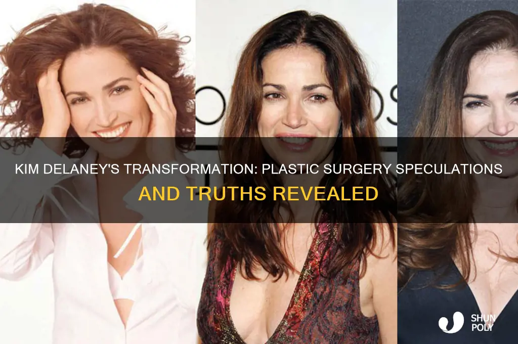 did kim delaney have plastic surgery