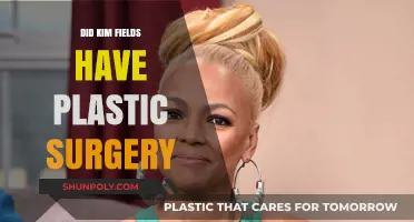 Kim Fields Plastic Surgery: Fact-Checking the Rumors and Speculations