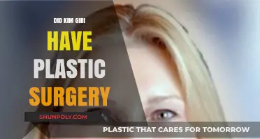 Kim Giri's Transformation: Plastic Surgery Rumors Explored and Debunked