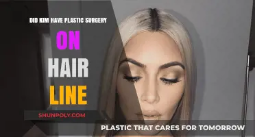 Kim's Hairline Transformation: Plastic Surgery or Natural Change?