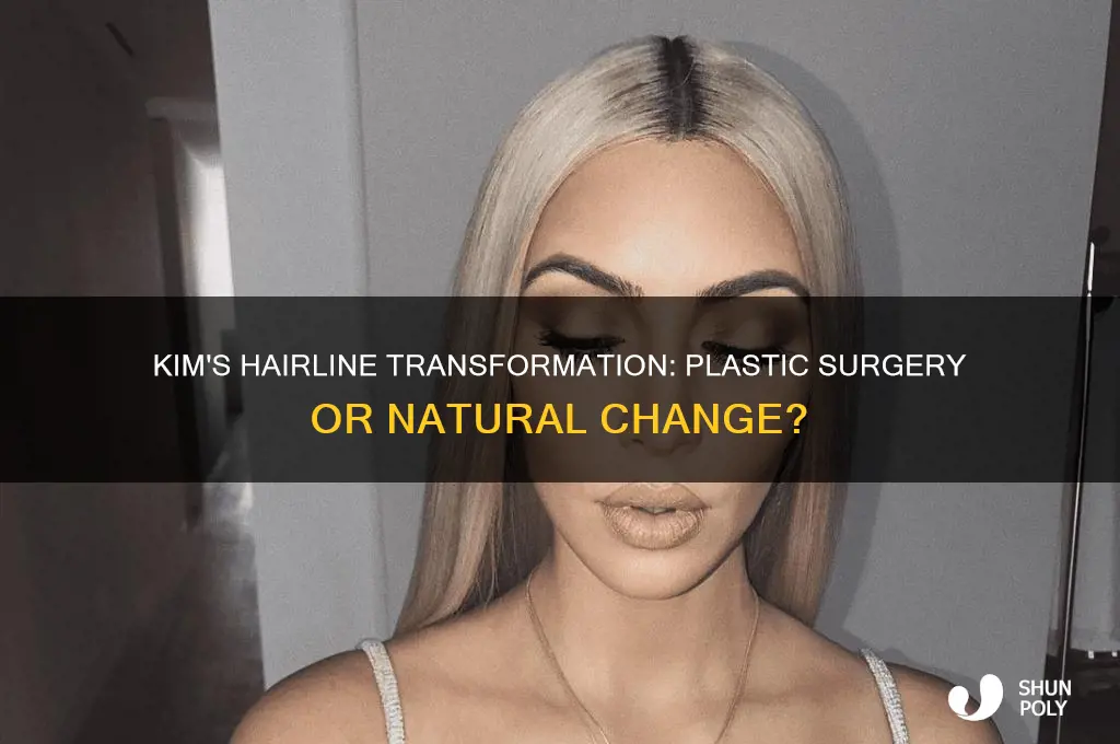 did kim have plastic surgery on hair line