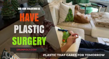 Kim Holderness Plastic Surgery: Fact-Checking the Transformation Rumors