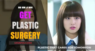 Kim Ji Won Plastic Surgery: Fact-Checking the Rumors and Speculations
