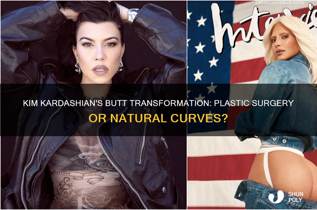 did kim kardashian get plastic surgery on her butt