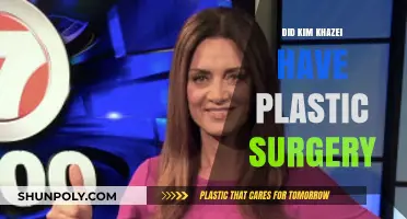 Kim Khazei Plastic Surgery: Fact-Checking the Rumors and Speculations