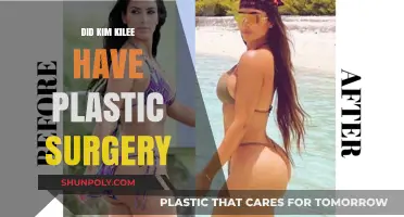 Kim Kilee's Transformation: Plastic Surgery Rumors Explored and Debunked
