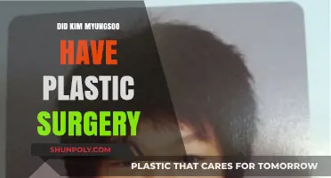 Kim Myungsoo's Transformation: Plastic Surgery Rumors Explored and Debunked