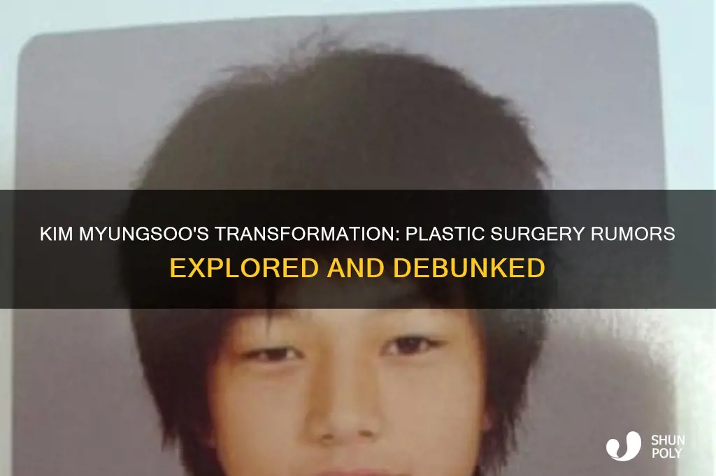 did kim myungsoo have plastic surgery