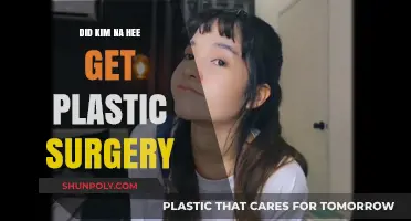 Kim Na Hee's Transformation: Plastic Surgery Rumors Explored