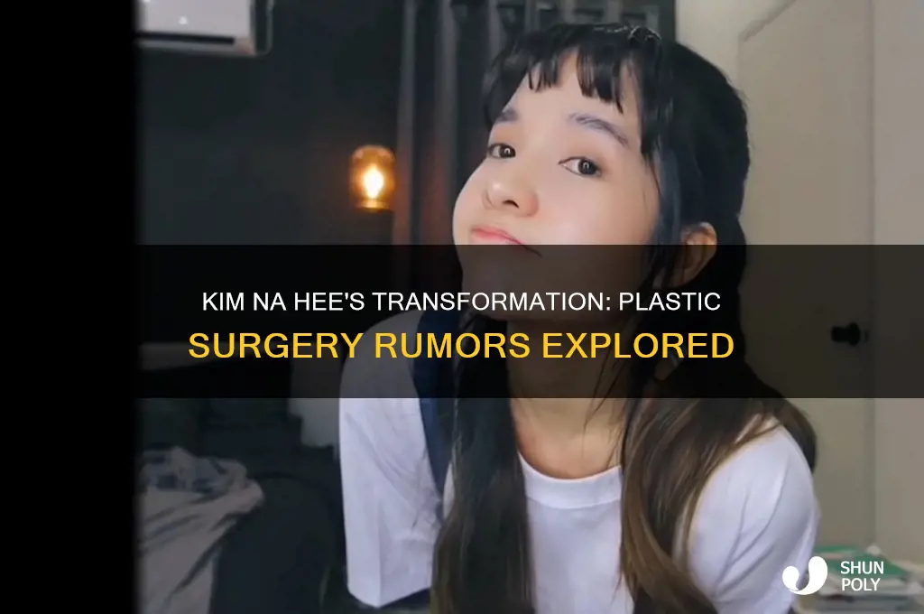 did kim na hee get plastic surgery