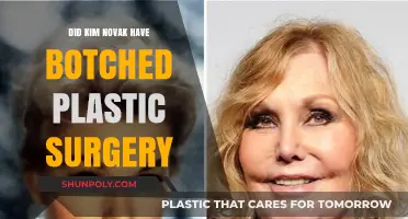 Kim Novak's Plastic Surgery: Truth Behind the Botched Rumors