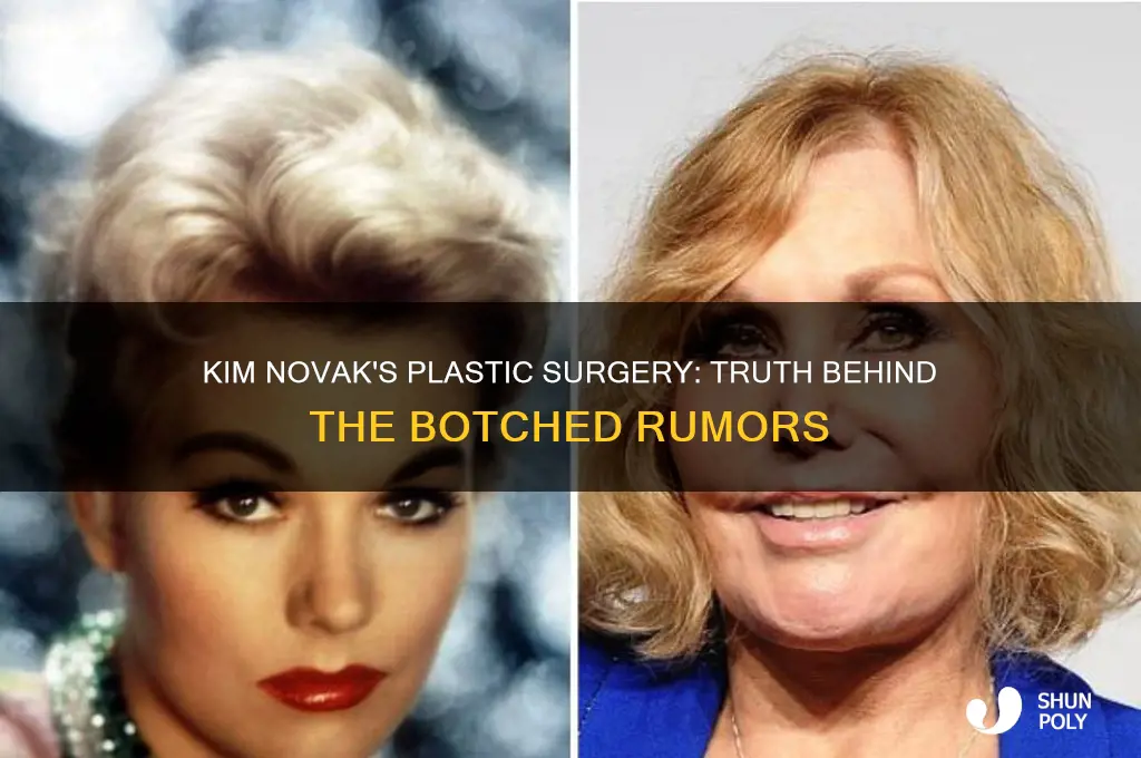 did kim novak have botched plastic surgery