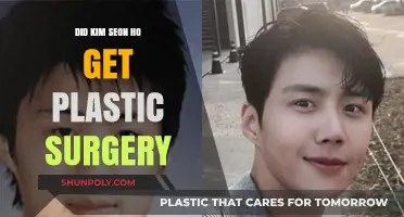 Kim Seon Ho Plastic Surgery: Fact-Checking the Rumors and Speculations