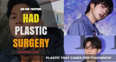 Kim Taehyung's Transformation: Plastic Surgery Rumors Explored