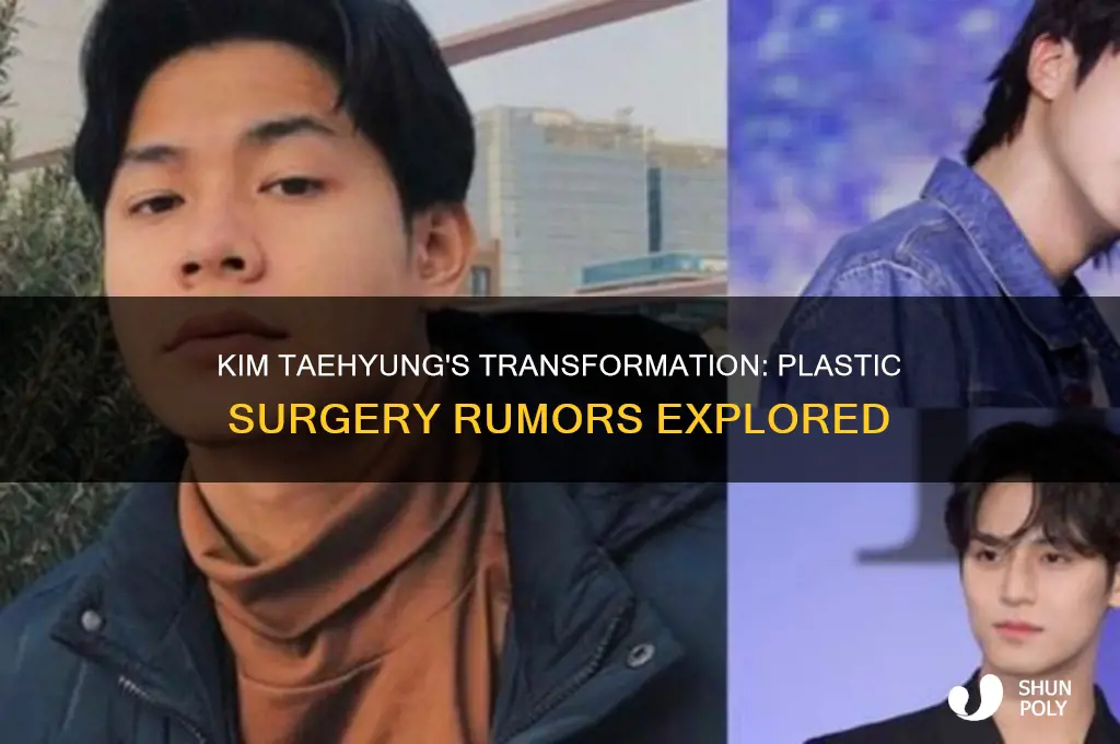 did kim taehyung had plastic surgery
