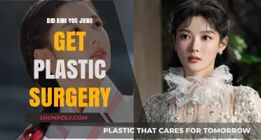 Kim Yoo Jung Plastic Surgery: Fact or Fiction? Unveiling the Truth