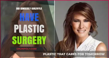 Kimberly Guilfoyle's Transformation: Plastic Surgery Speculations and Truths