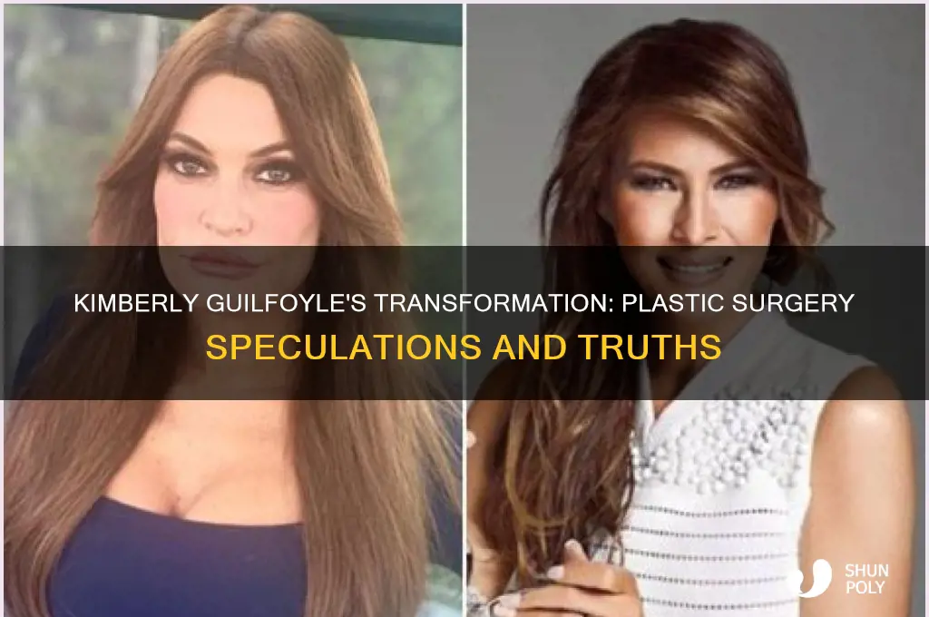 did kimberly guilfoyle have plastic surgery