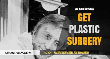 Kirk Douglas Plastic Surgery: Fact or Fiction? Unveiling the Truth