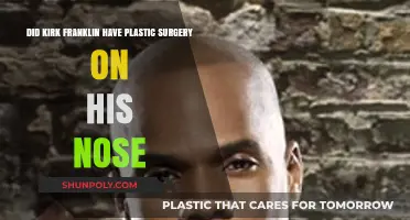 Kirk Franklin's Nose Transformation: Plastic Surgery Speculations Explored