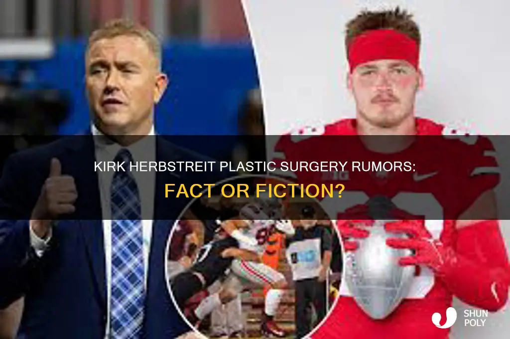 did kirk herbstreit get plastic surgery