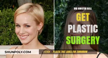 Kirsten Bell's Transformation: Plastic Surgery Rumors Explored
