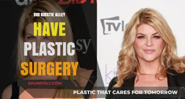 Kirstie Alley's Transformation: Plastic Surgery Rumors and Reality Revealed