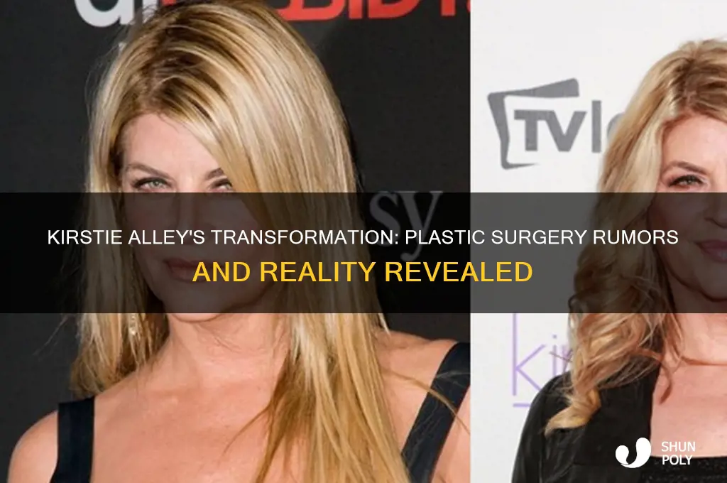 did kirstie alley have plastic surgery