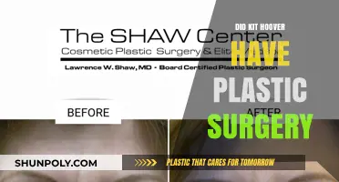 Kit Hoover Plastic Surgery: Fact-Checking the Rumors and Speculations
