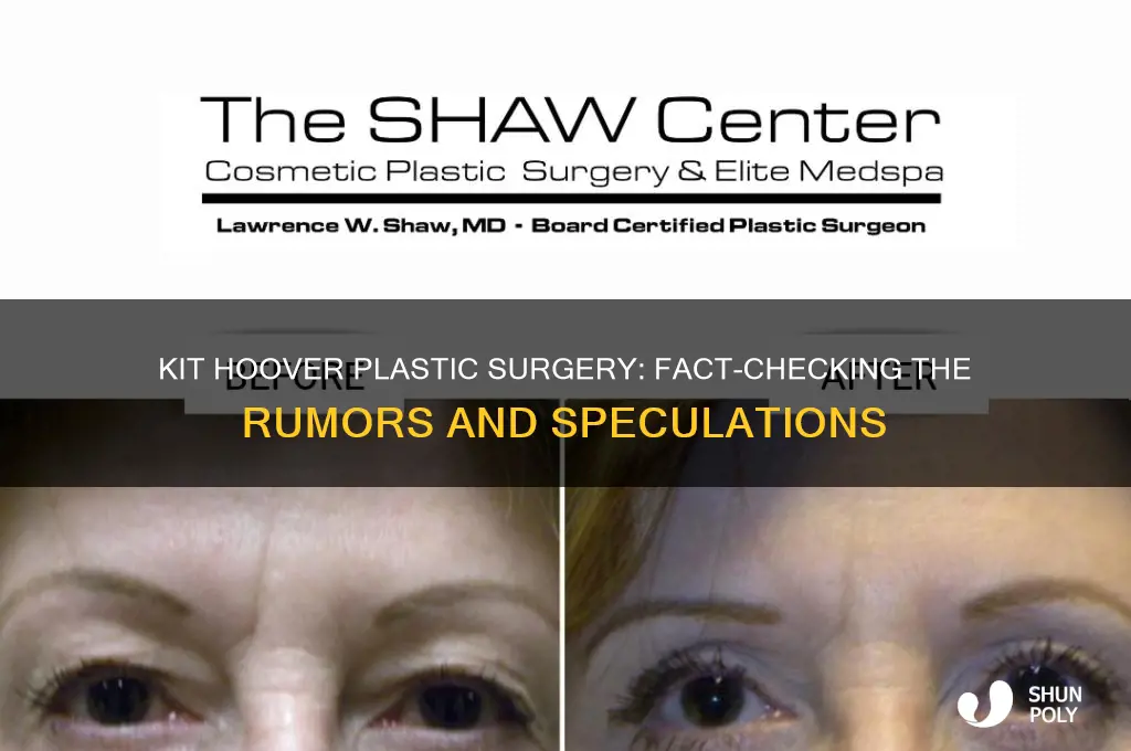 did kit hoover have plastic surgery